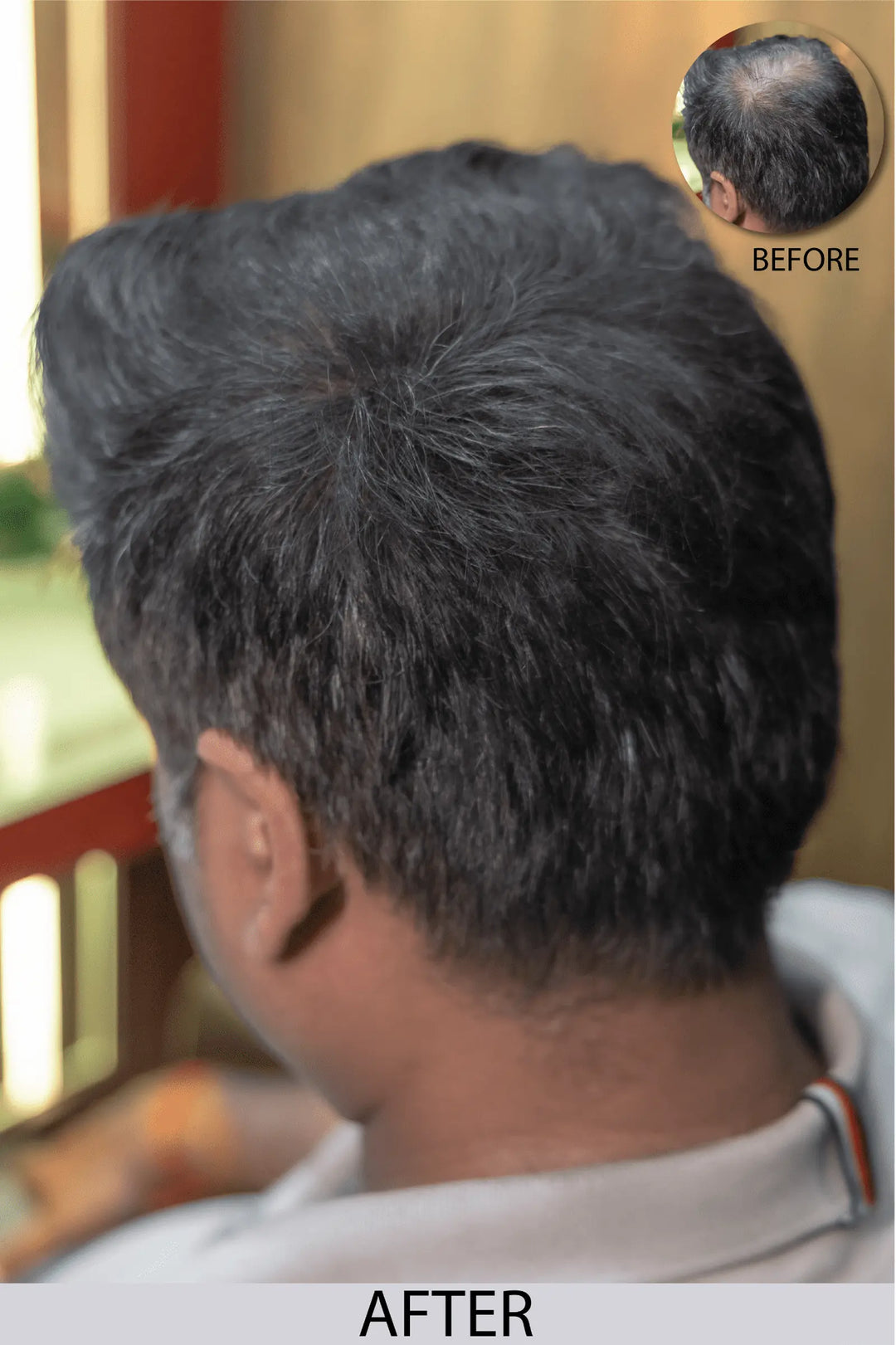 Hair Fiber