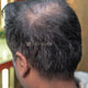 Hair Fiber