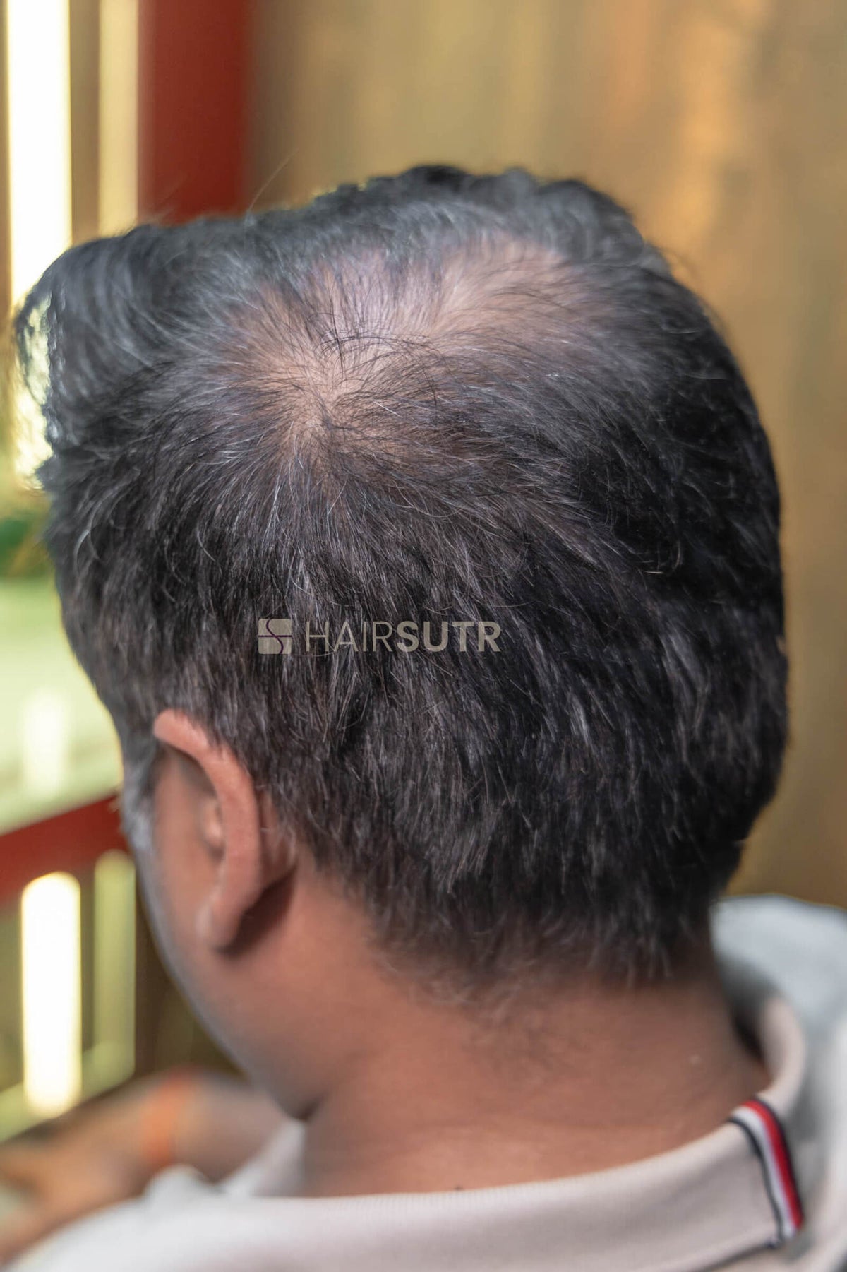 Hair Fiber