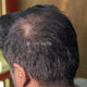 Hair Fiber