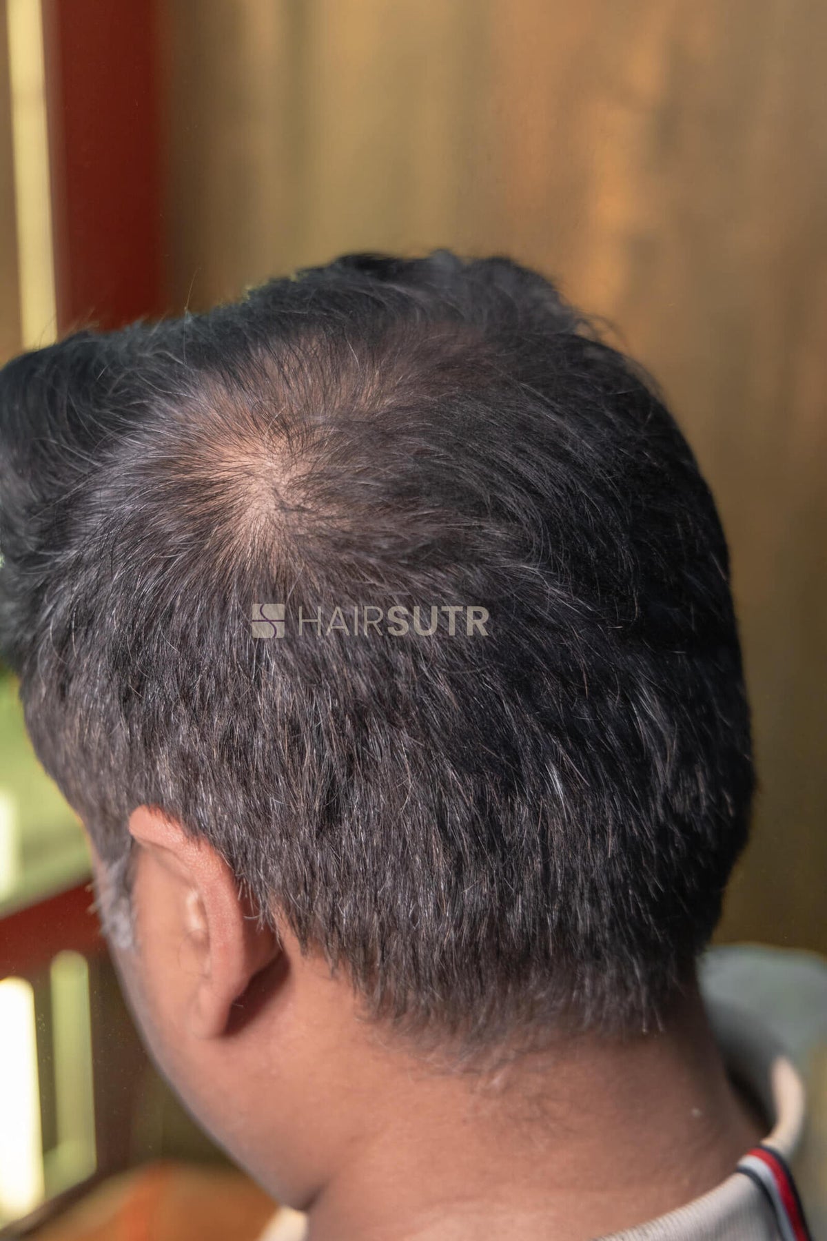 Hair Fiber