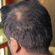 Hair Fiber for men