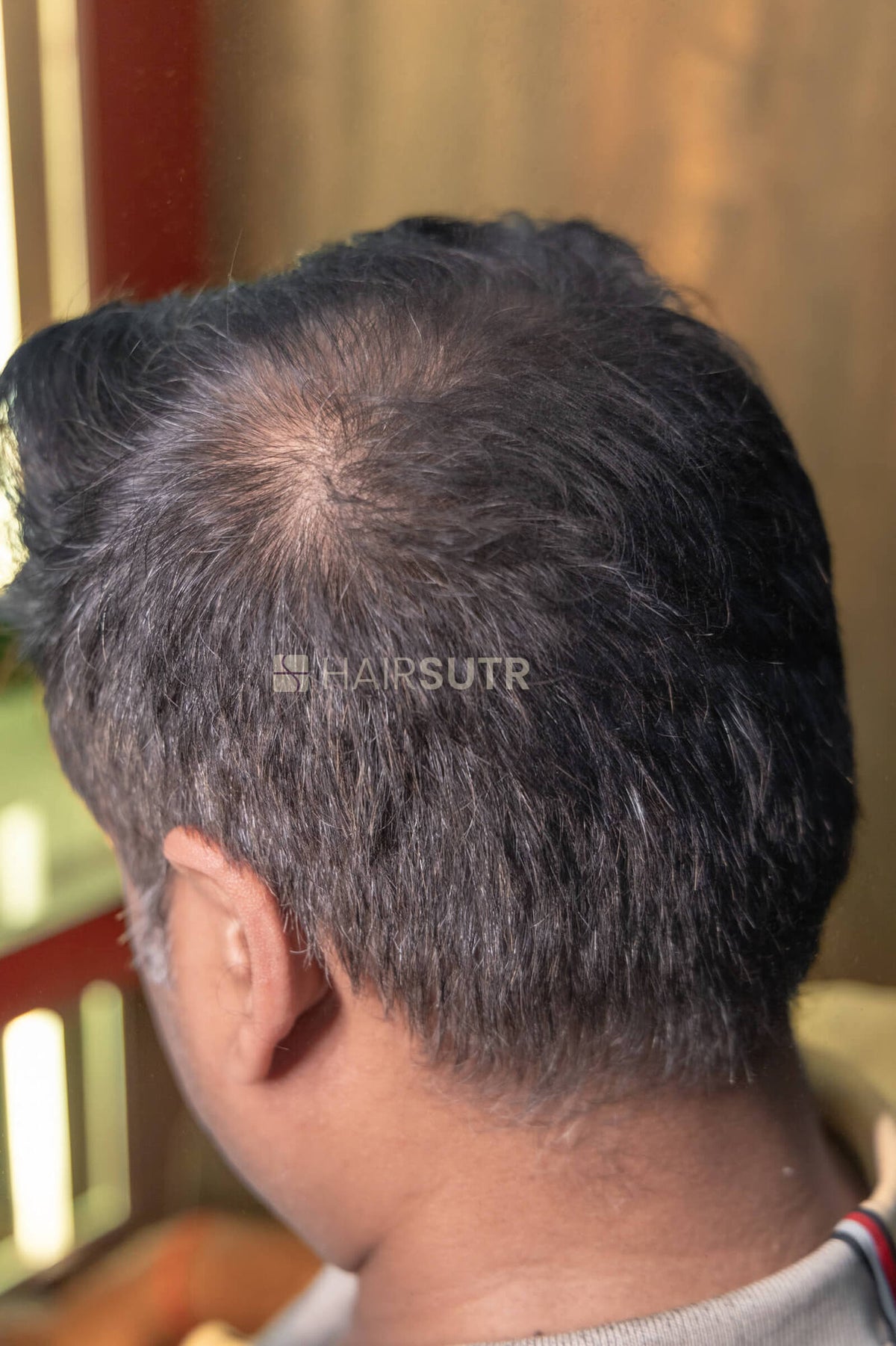 Hair Fiber for men