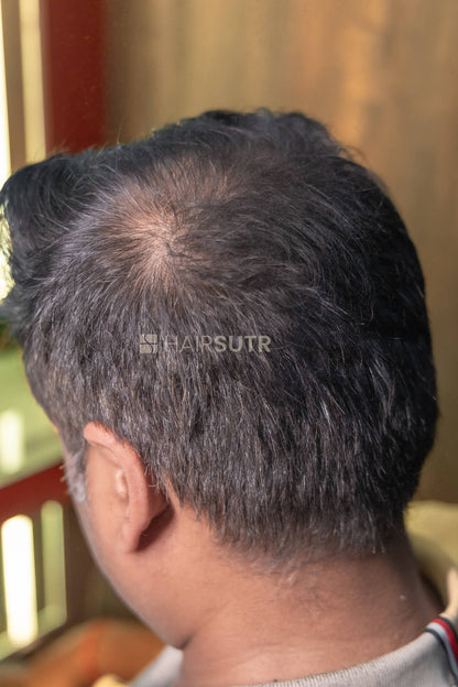 Hair Fiber for men
