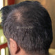 Hair Fiber for men