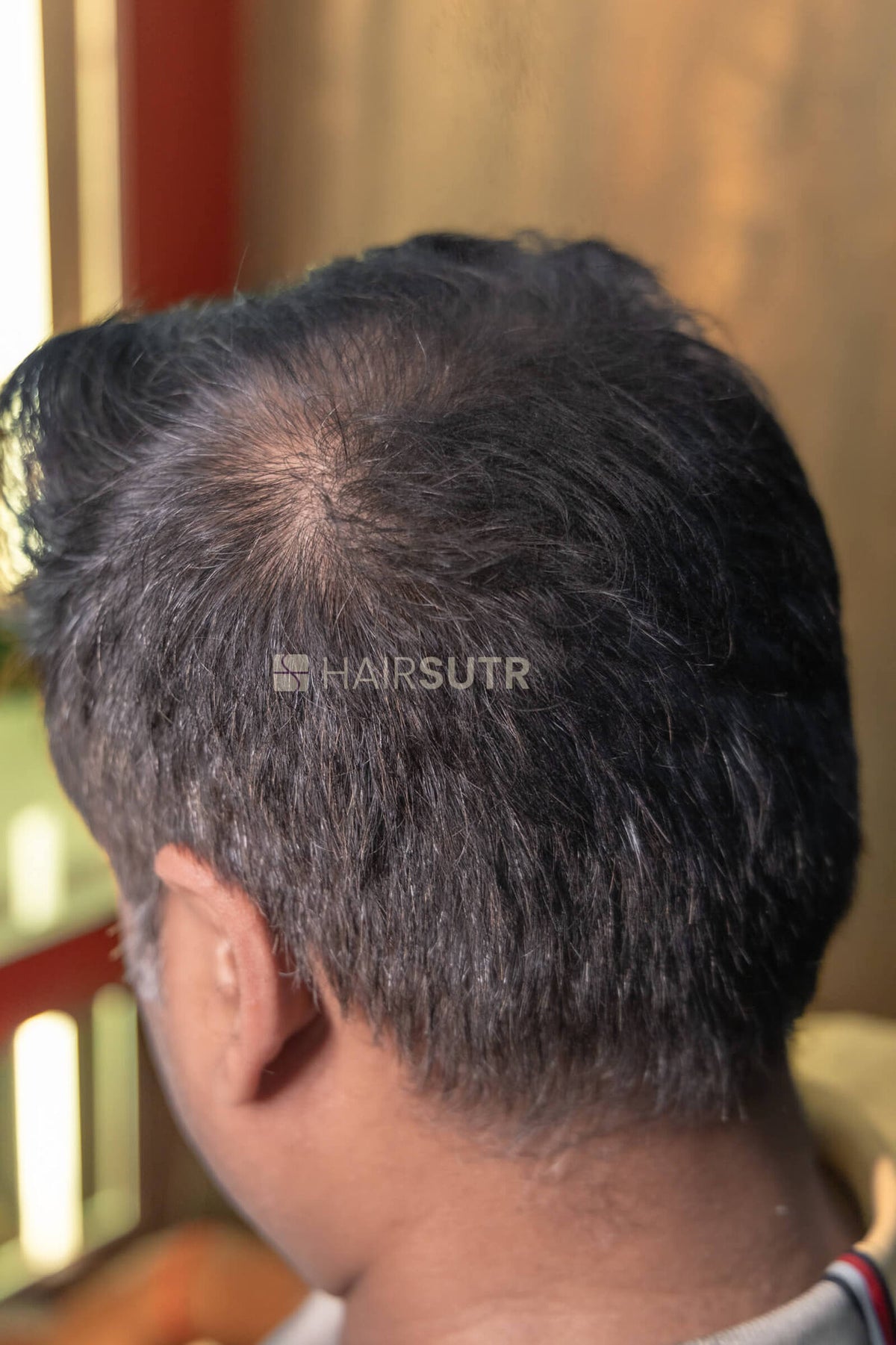 Hair Fiber for men