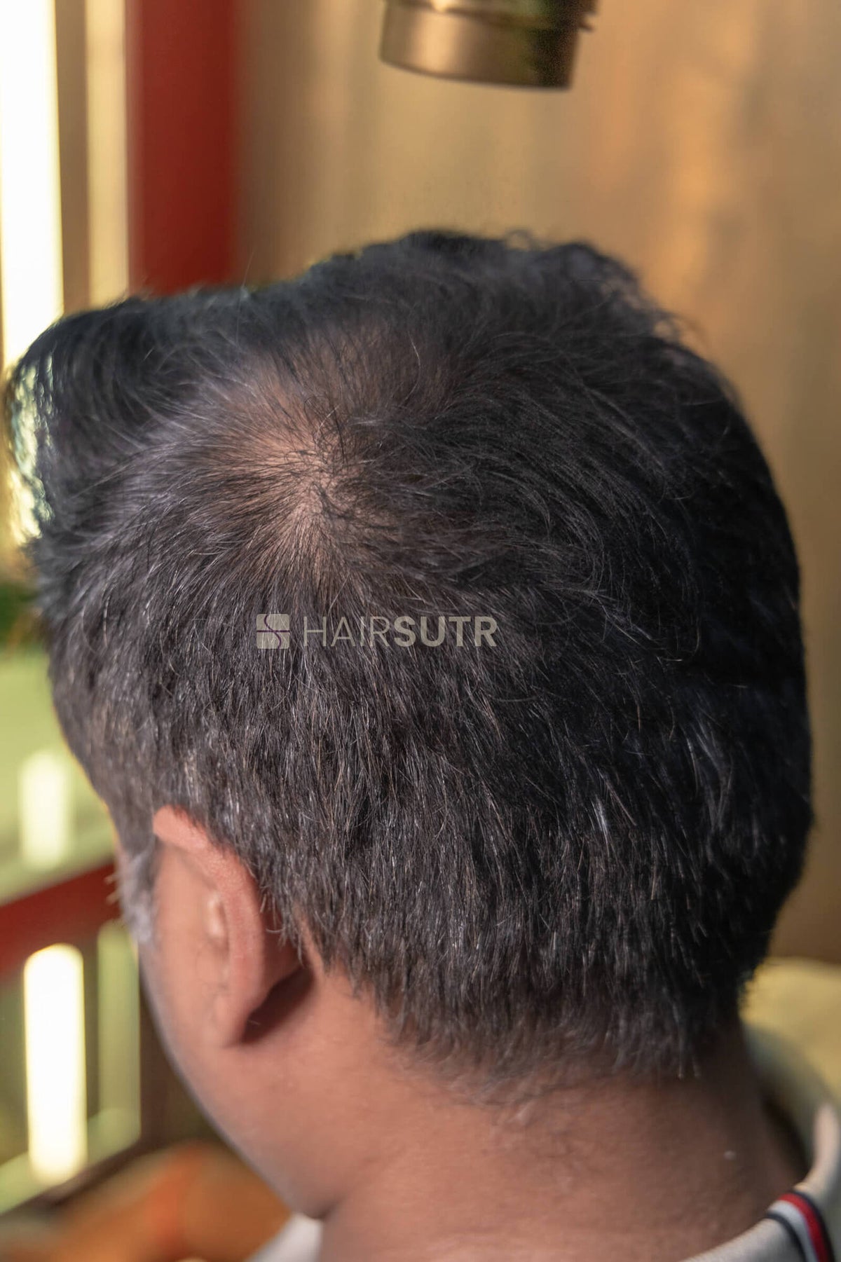 Hair Fiber for men