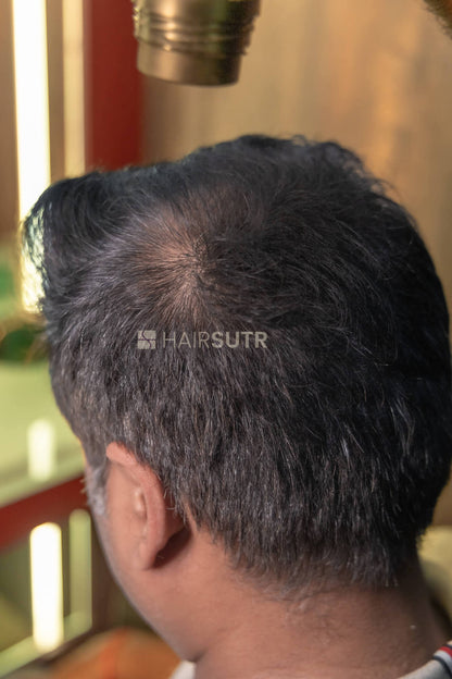 Hair Fiber for men