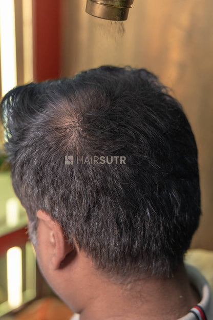 Hair Fiber for men