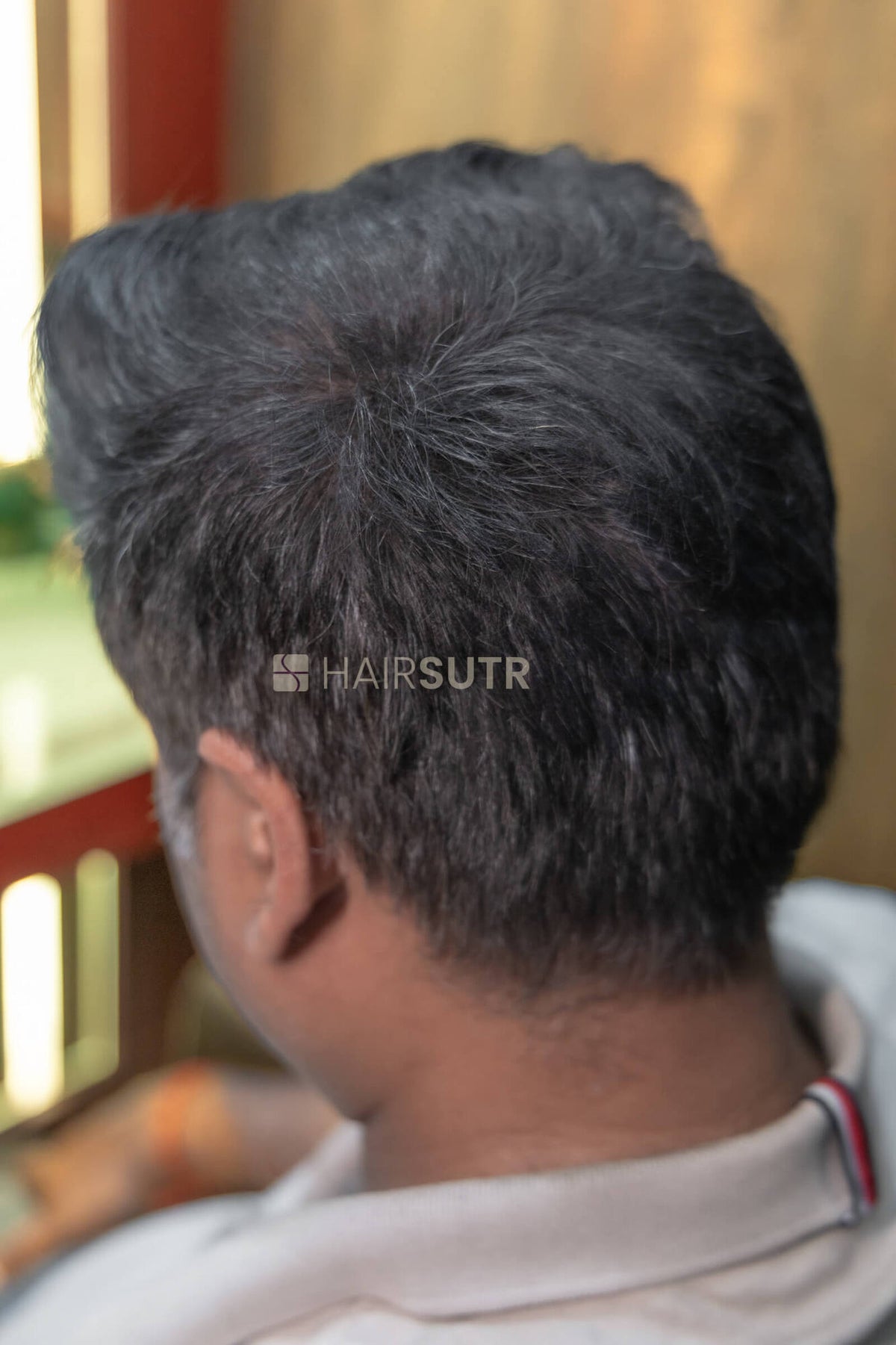 Hair Fiber