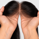 Hairline Patch