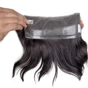 Hairline
